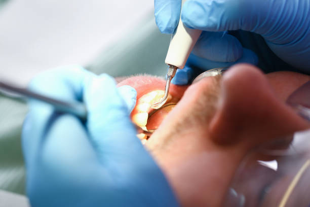 Best Walk-In Emergency Dentist in Pleasant Hill, PA